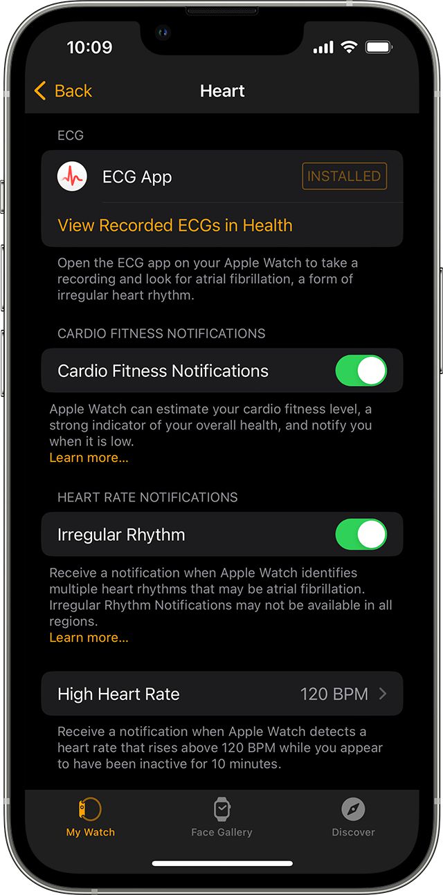 从健康监测到生命守护：Apple Watch科技创新与人文关怀交织的十年(图5)